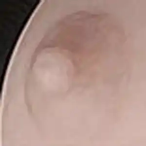 Skin Tone